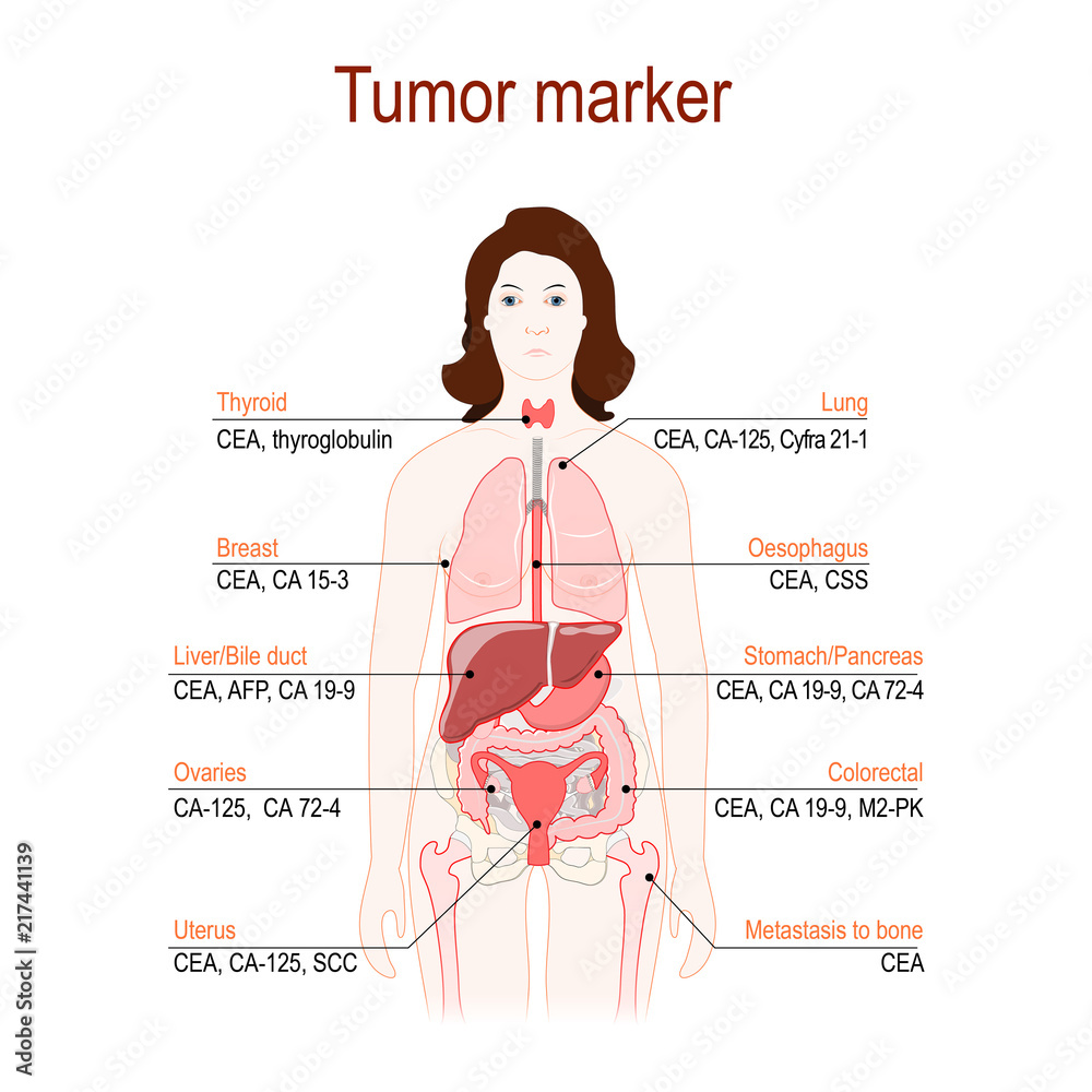 Tumor marker or biomarker. silhouette of a woman with internal organs. Tumor marker or biomarker. silhouette of a woman with internal organs.