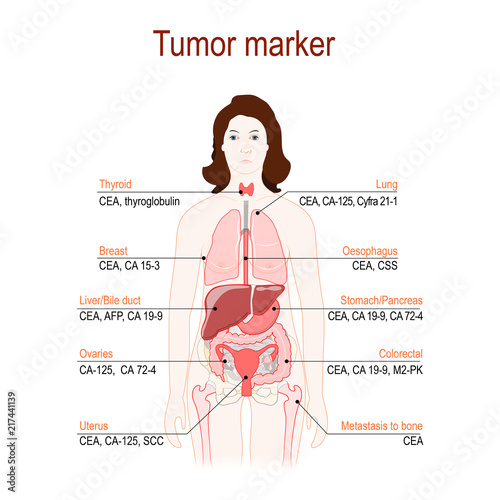 Tumor marker or biomarker. silhouette of a woman with internal organs.