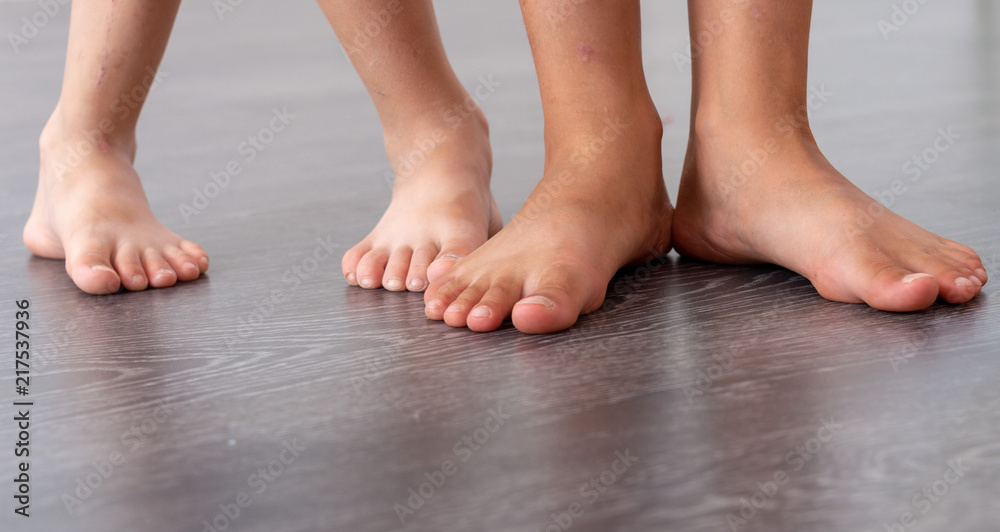 three pairs of legs on a laminate background