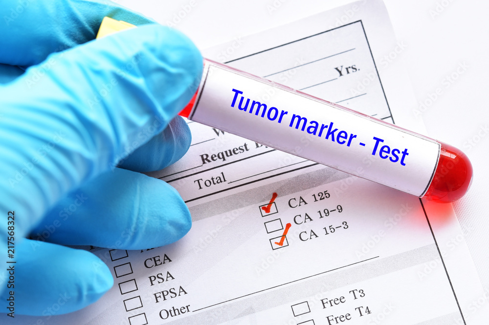 Blood sample tube with laboratory requisition form for tumor marker test  foto de Stock | Adobe Stock