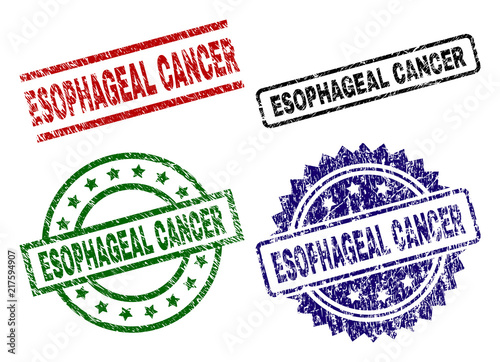 ESOPHAGEAL CANCER seal prints with corroded surface. Black, green,red,blue vector rubber prints of ESOPHAGEAL CANCER caption with retro surface. Rubber seals with round, rectangle, medal shapes.