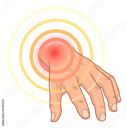 Hand ache