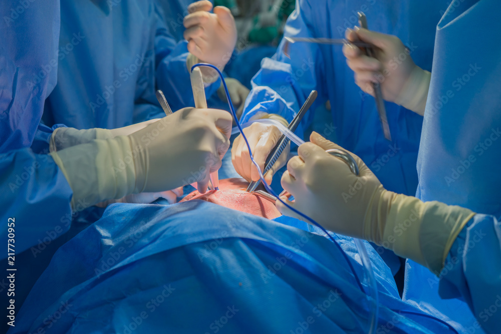 Doctors team wear blue coat perform heart surgery at the operating room in the hospital. Doctors team wear blue coat perform heart surgery at the operating room in the hospital.