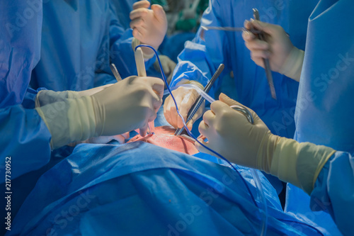 Doctors team wear blue coat perform heart surgery at the operating room in the hospital.