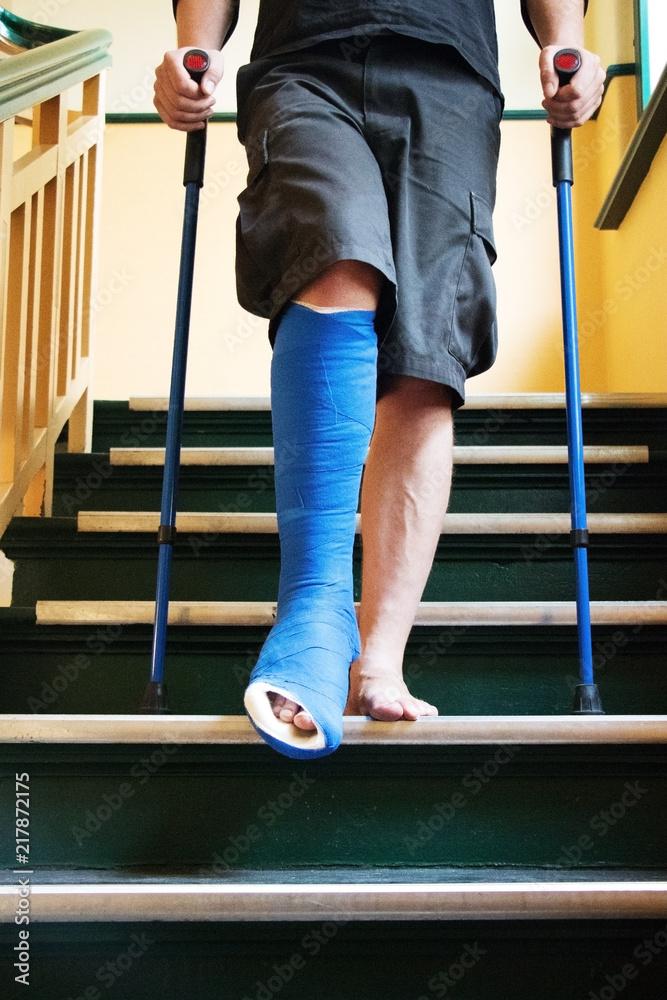 men with broken foot and crutches on stairs Stock Photo | Adobe Stock