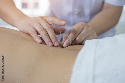 Traditional Chinese Medicine Treatment - Acupuncture