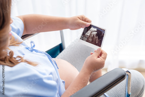 Young mother in the hospital chair holding and looking to the x-ray film of her baby. Mother preparing for the newborn.