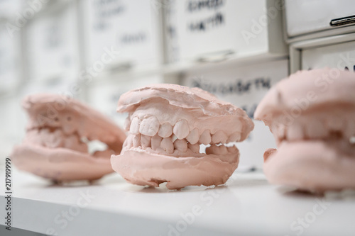 Dental casting gypsum model plaster cast stomatologic human jaws prothetic laboratory, technical shots photo