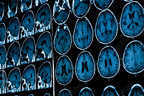 Research in medicine. CT scan of the patient.