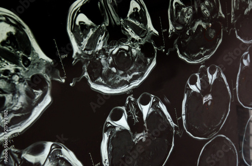 Research in medicine. CT scan of the patient.