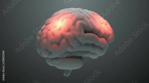 Medical theme 3d render brain with orange zones that symbolize damage or pain. Headache zone concept. Activation of brain intelligence zone. 
