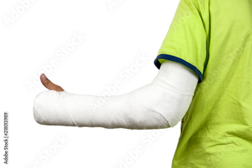 Broken hand in cast photo