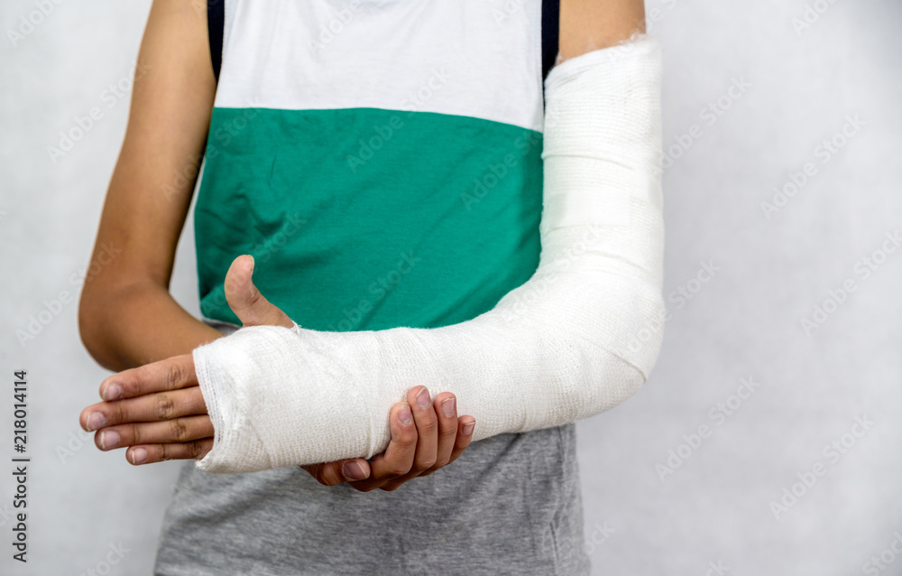 Obraz premium Broken arm in cast