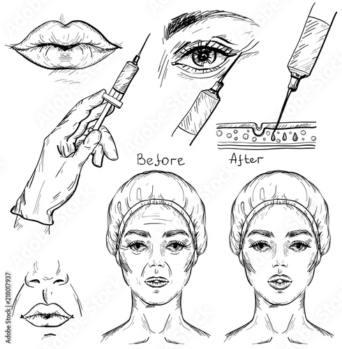 Sketch of botox injection, cosmetic procedure set.