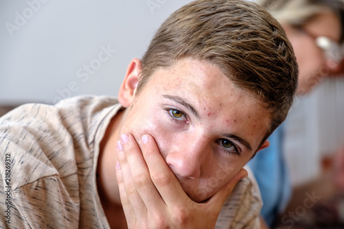 Obraz na plátně The portrait of pimply teenager covered his mouth with his hand