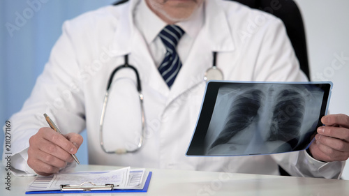 Pulmonologist looking at lung x-ray prescribing treatment to patient, healthcare photo