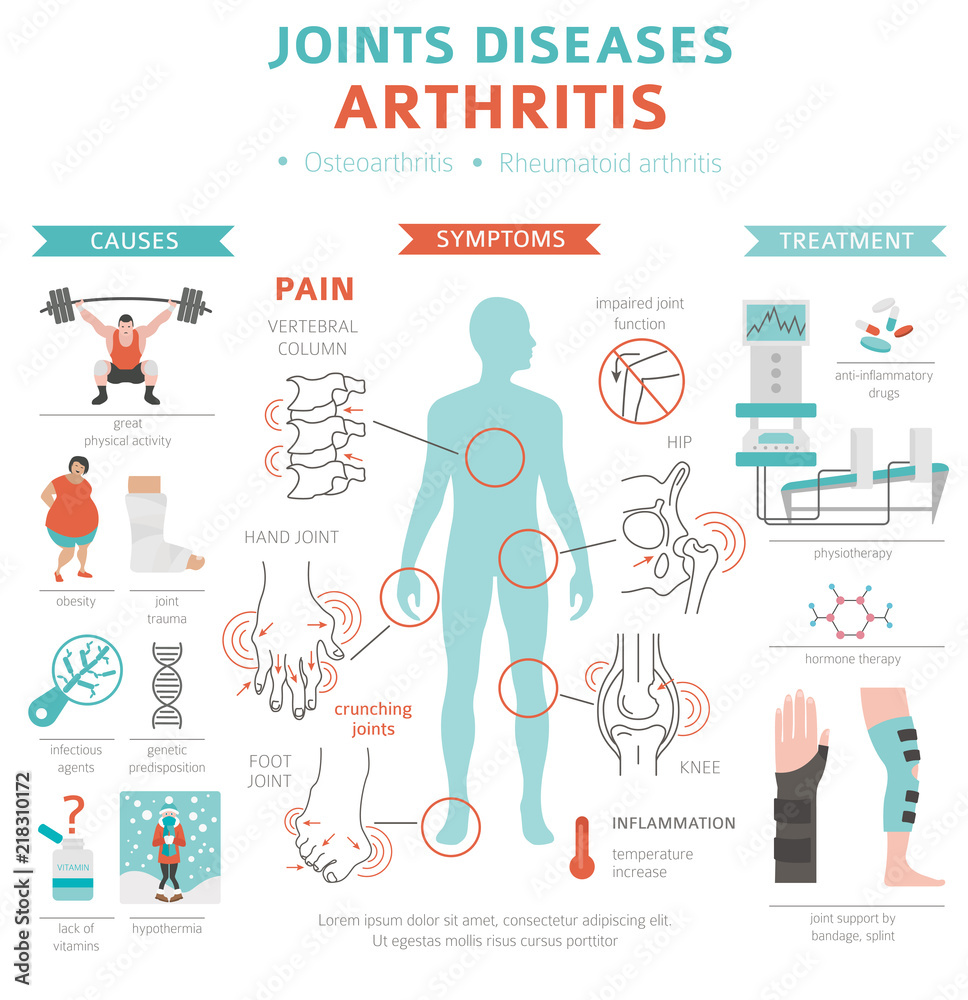 Joints diseases. Arthritis symptoms, treatment icon set. Medical infographic design