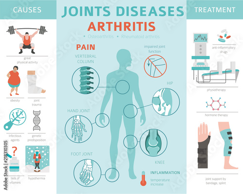 Joints diseases. Arthritis symptoms, treatment icon set. Medical infographic design photo