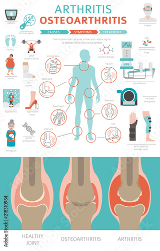 Joints diseases. Arthritis, osteoarthritis symptoms, treatment icon set. Medical infographic design