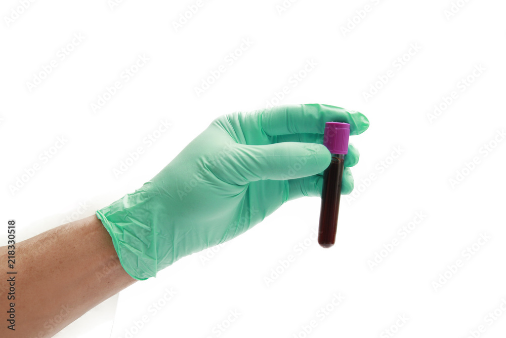 Hand of a doctor holding a bottle of blood sample Hand of a doctor holding a bottle of blood sample