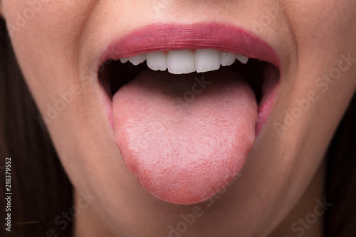 Obraz na plátně Woman Showing Tongue