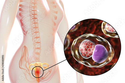 Female chlamydiosis, medical concept. 3D illustration showing close-up view of Chlamydia trachomatis bacteria infecting cells of cervix uteri photo