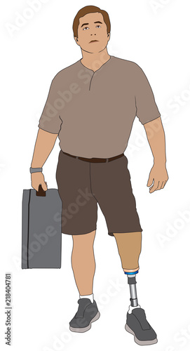 A left leg amputee on a trip is holding a suitcase and looking at a reader board