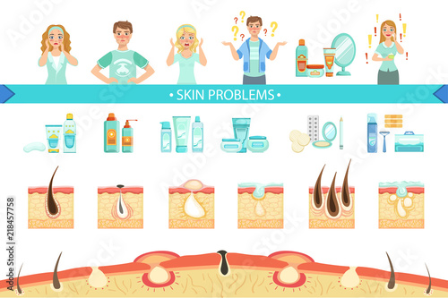 Skin Problems Infographic Medical Poster. Cartoon Style Healthcare Acne Issue Info Illustration.