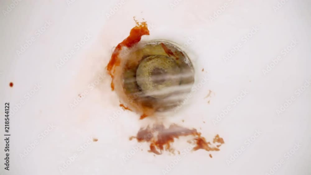 Washing away blood stains from a bathroom sink.
Washing away blood stains from a bathroom sink.