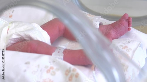 Little feet and hand a newborn baby and newborn babies sleepiing at nursery  at the hospital, focus Neonatology,Cared for by a doctor neonatologist and nurse. Medical devices cardiogram cannula tube. photo