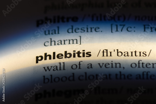 phlebitis photo