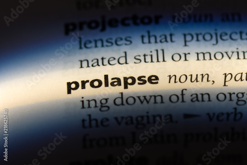 prolapse photo