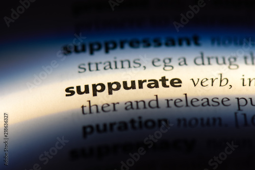 suppurate