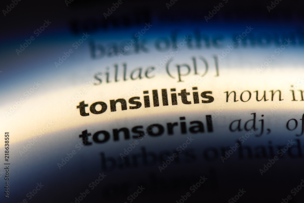tonsillitis tonsillitis