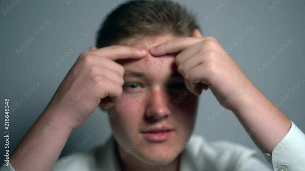 Skin problem. Young man refusing medicine for skin treatment in puberty period. Skin problem. Young man refusing medicine for skin treatment in puberty period.