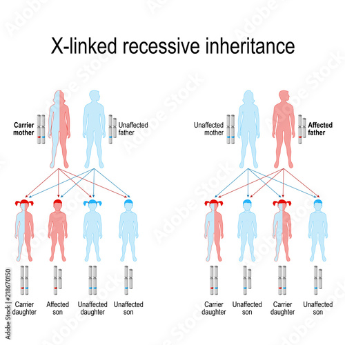 X-linked recessive inheritance photo