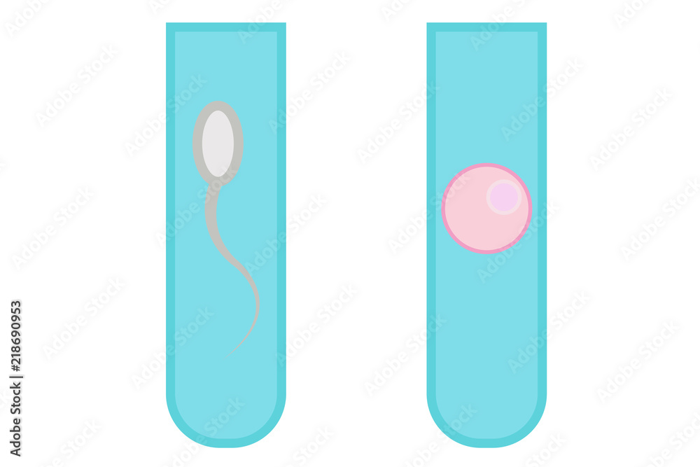 Fecundación in vitro para tener hijos. Fecundación in vitro para tener hijos.
