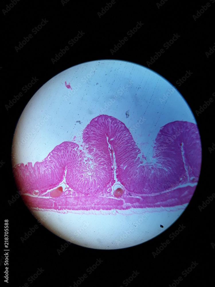 Intestino Delgado tejido bajo microscopio zoom 40x Stock Photo | Adobe ...