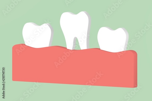 loose tooth - dental cartoon 3d render