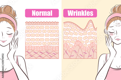 woman with wrinkles problem