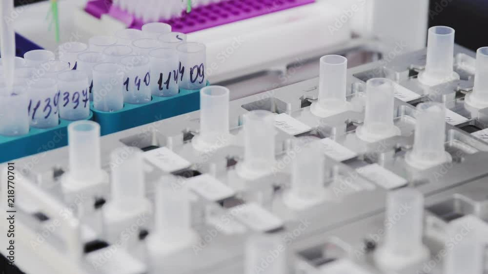 At the medical center in the lab, the robot automatically performs the analysis to determine cancerous cells in the patient samples At the medical center in the lab, the robot automatically performs the analysis to determine cancerous cells in the patient samples