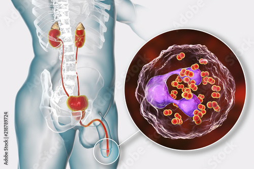 Male gonorrhea, medical concept. 3D illustration showing close-up view of Neisseria gonorrhoeae bacteria inside neutrophils with incomplete phagocytosis found in smear from man urethra photo