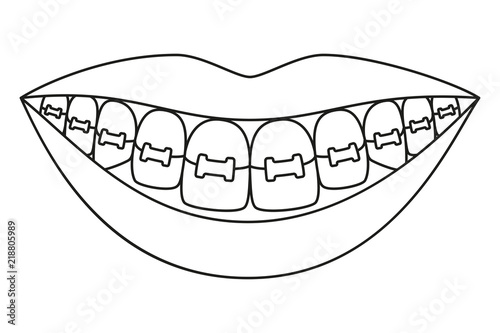 Line art black and white healthy smile in braces