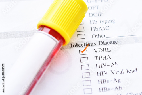 Blood sample tube with laboratory requisition form for VDRL test, diagnosis for syphilis infection photo