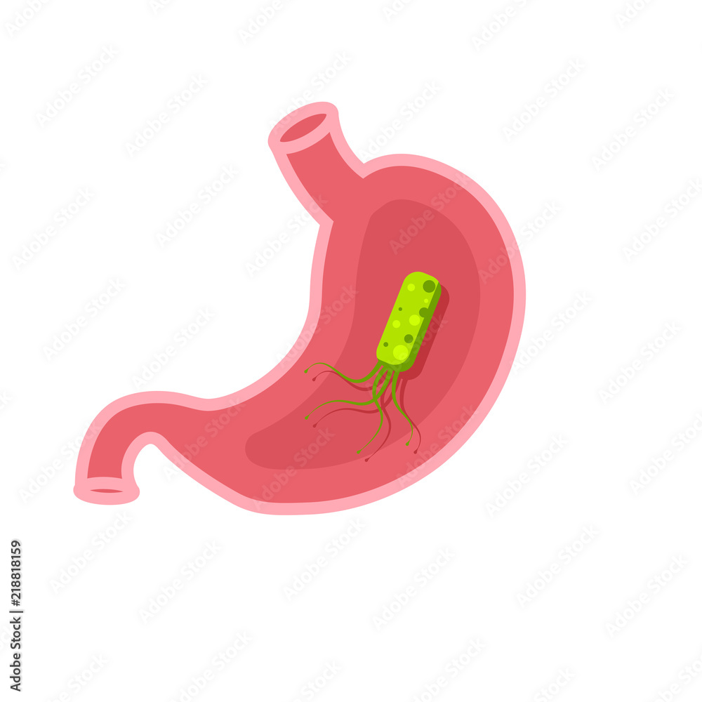Fotografie Helicobacter Pylori In Stomach