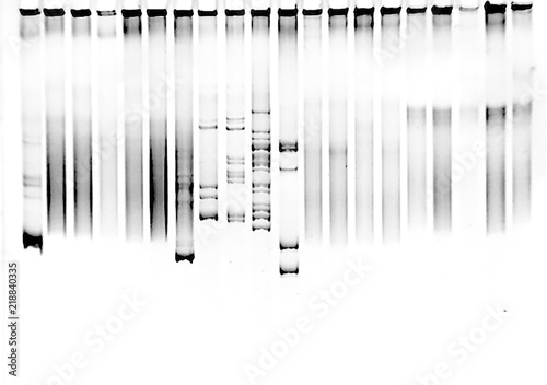 Mutation screening in polyacrylamide gel