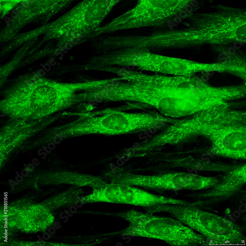 Fibroblast cells mebrane labeled with fluorescent dye