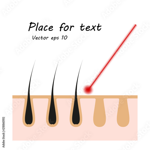 Icon illustration of skin hair. Vector element on isolated background for cosmetic laser hair removal projects, medicine with space for text.