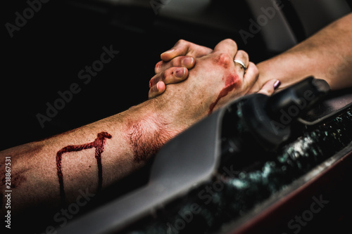 Person Clasping Injured Person s Scratched and Blood Smeared Hand