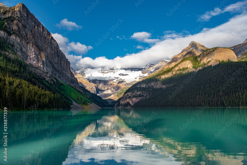 Lake Louise View 22